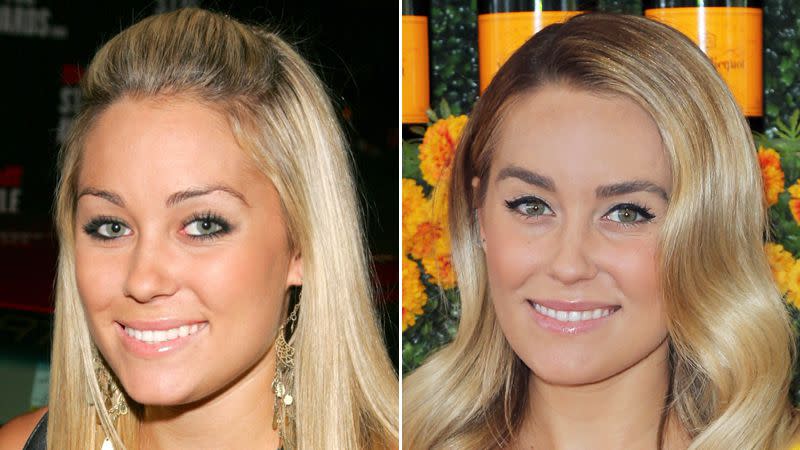 Lauren Conrad