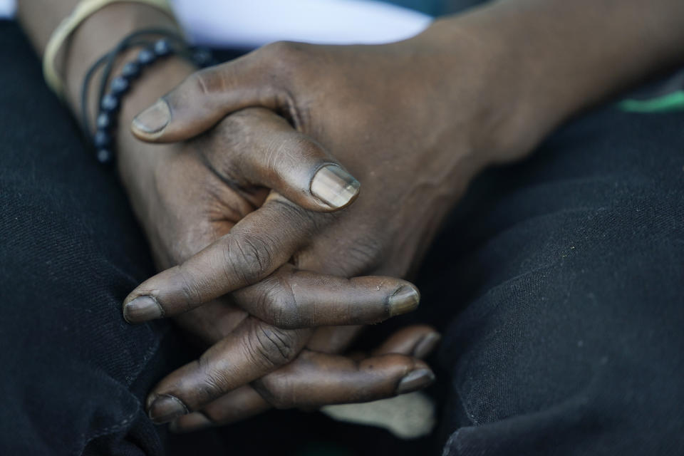 Jerry Simmons, 49, holds his hands together before entering a new mobile help unit run by Assisted Recovery Centers of America in a church parking lot in St. Louis on Thursday, May 20, 2021. Simmons sometimes imagines himself lying in one of those vacant houses where he sleeps, dead for days from an overdose before anyone discovers him. (AP Photo/Brynn Anderson)