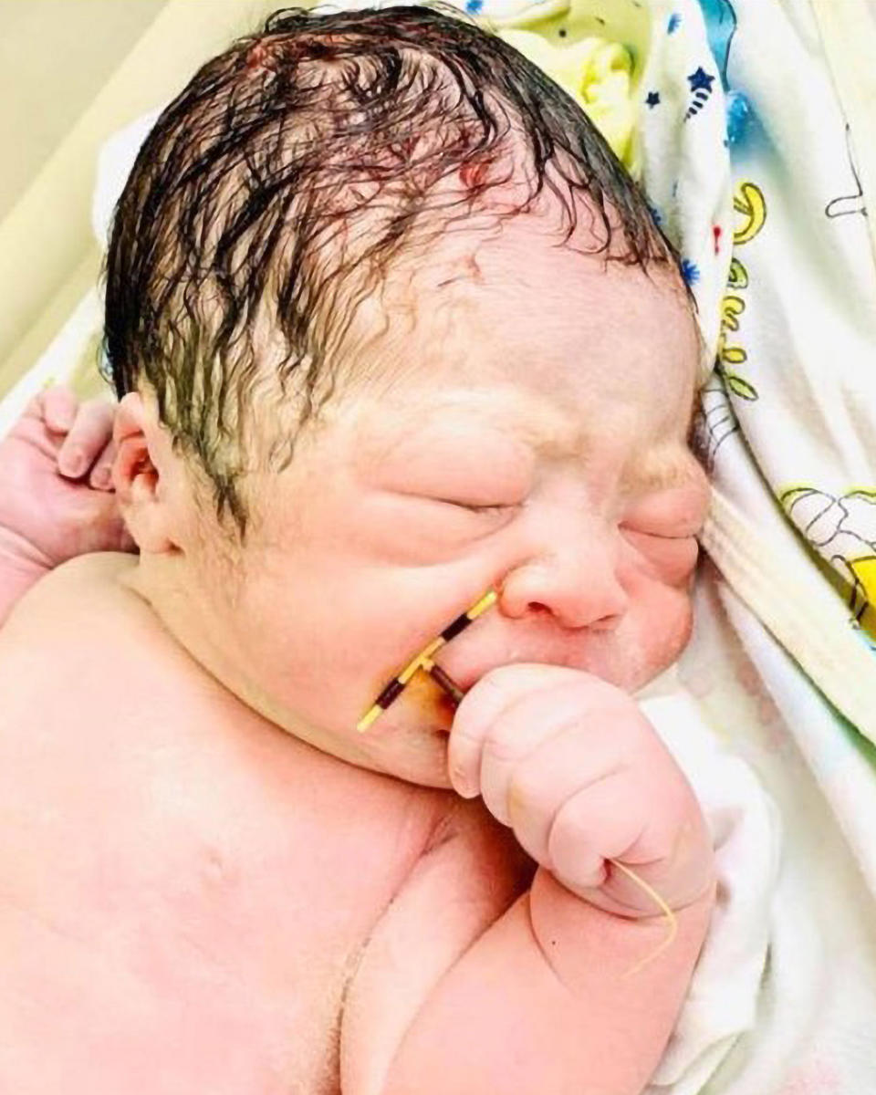 Photo shows a newborn baby boy in Hai Phong International Hospital with his eyes closed and the intrauterine device in his hand.