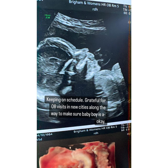 Riverdale's Vanessa Morgan shares sonogram of son's 'big foot