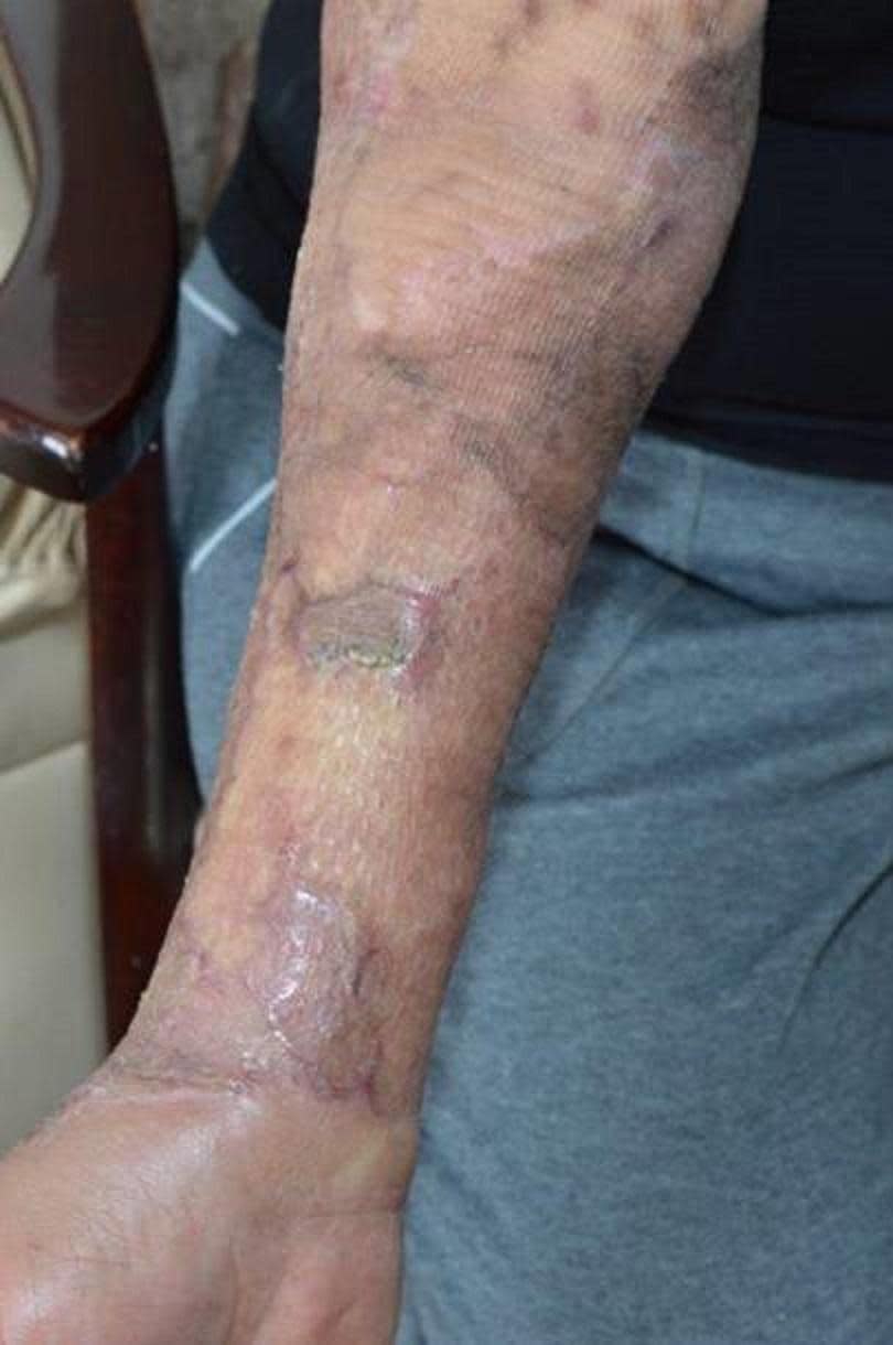 A 69-year-old woman was left permanently scarred by acid thrown by Whelan (Metropolitan Police)