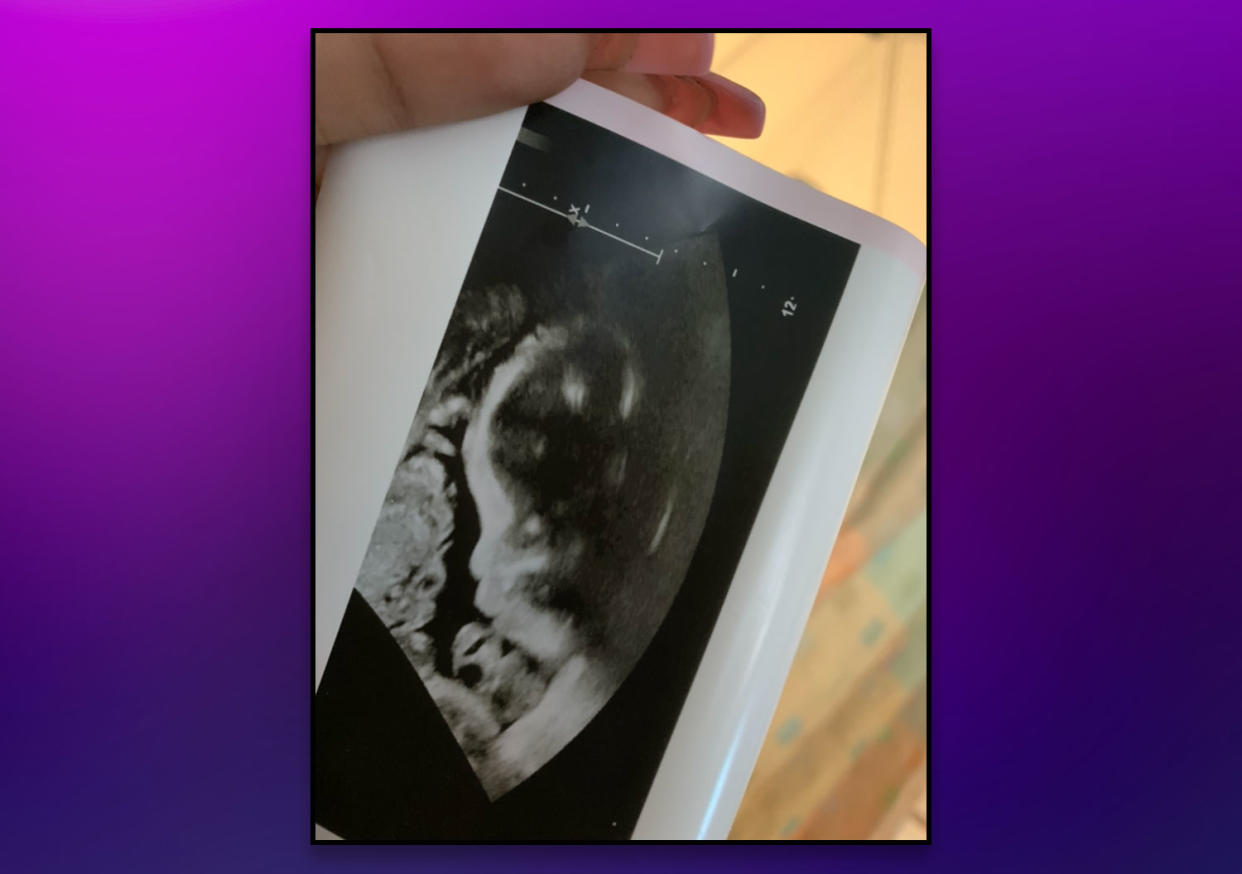 The author's baby girl, in-utero. (Photo courtesy of Kamilah Newton)