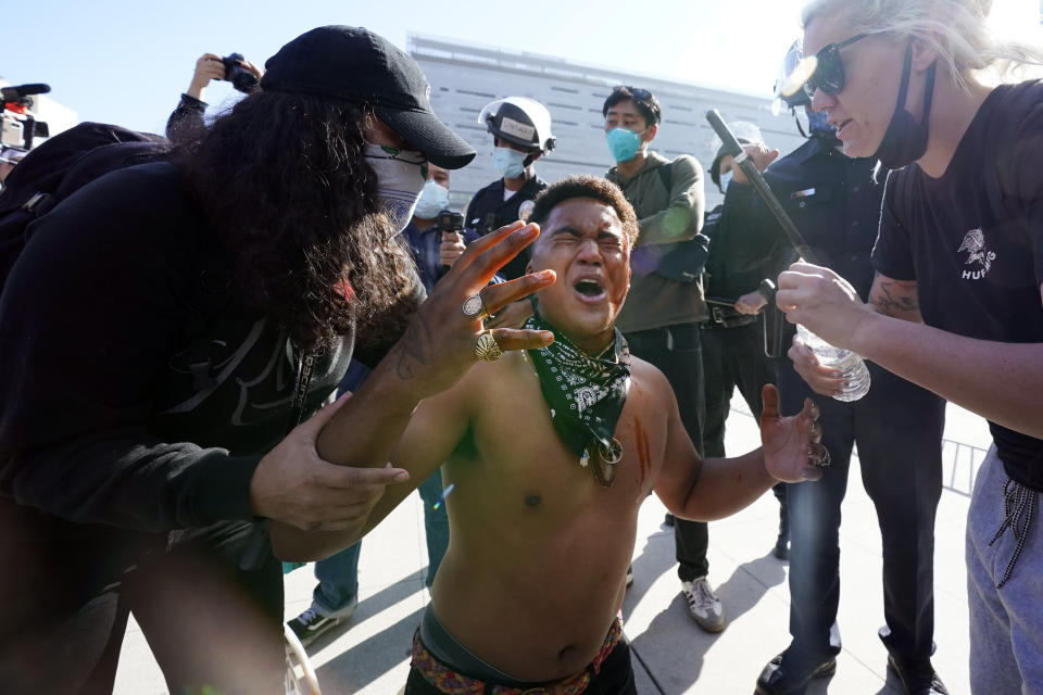 A counter demonstrator, center, yells after getting maced in the face by far-right demonstrators outside of City Hall Wednesday, Jan. 6, 2021, in Los Angeles. Demonstrators supporting President Donald Trump are gathering in various parts of Southern California as Congress debates to affirm President-elect Joe Biden's electoral college victory. (AP Photo/Marcio Jose Sanchez)