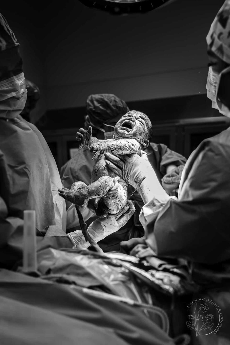Newborn held up by medical staff during a delivery in an operating room