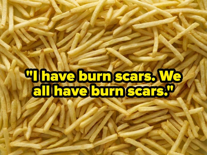 "I have burn scars. We all have burn scars" over fries