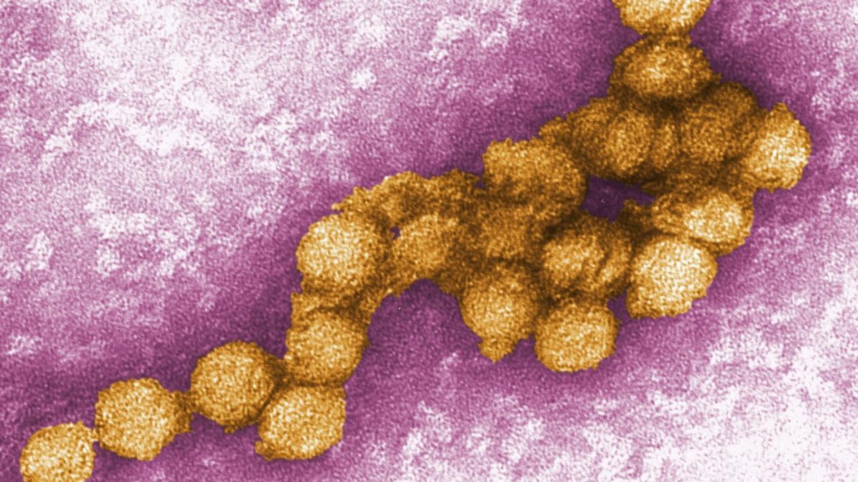 Das West-Nil-Virus unter dem Elektronenmikroskop.