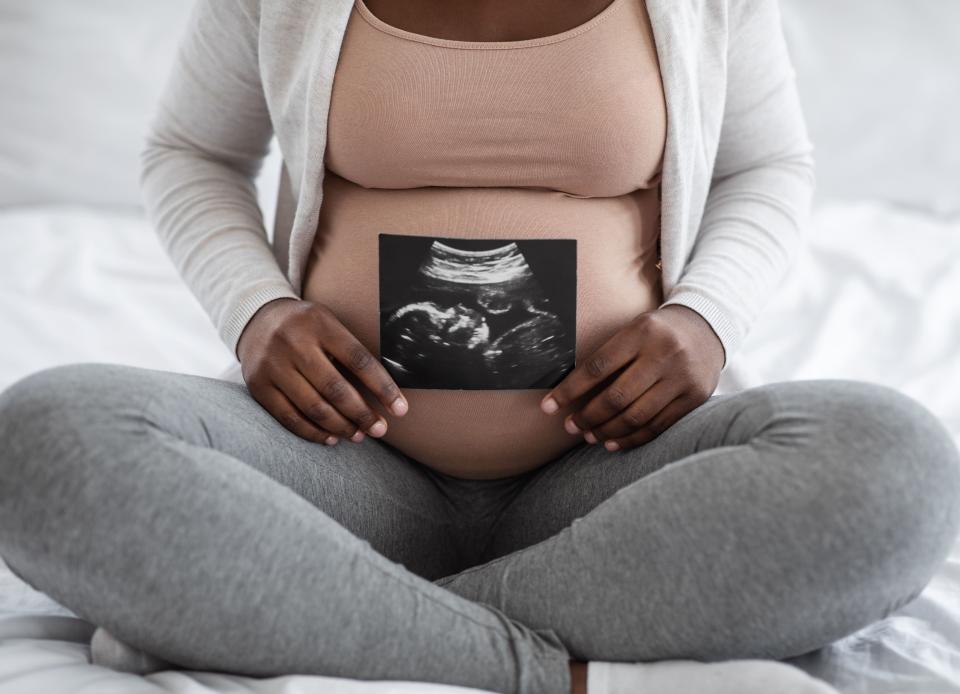 A New York state report found that racism and discrimination contributed to maternal mortality in 2018.