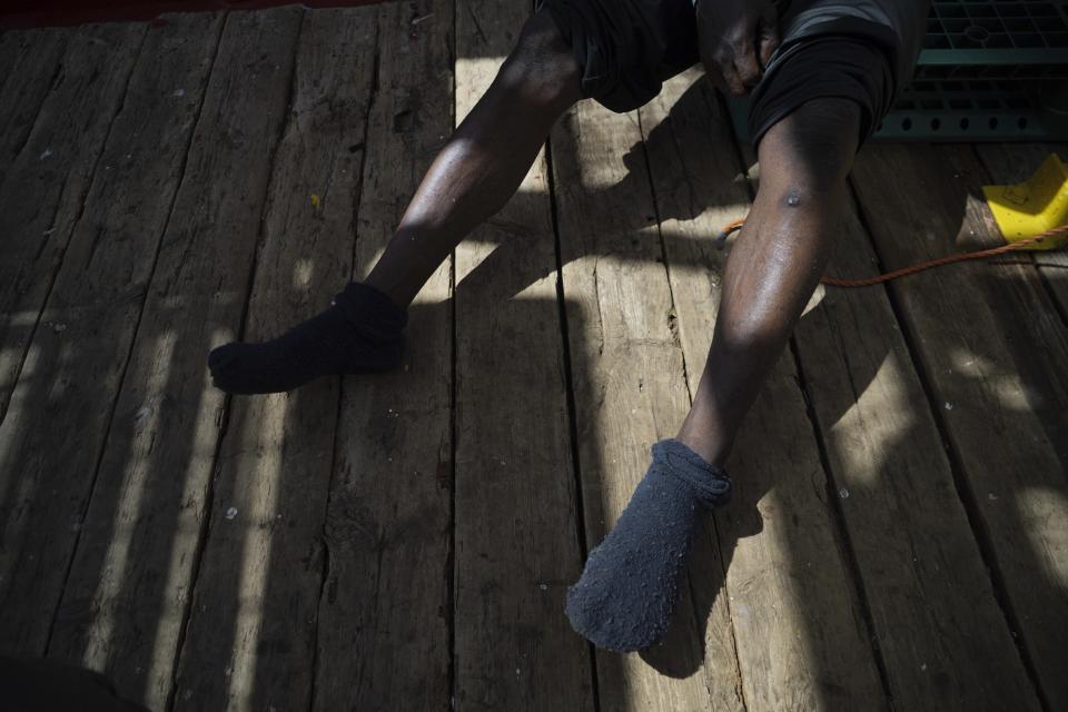 In this Sept. 19, 2019, Orobosa Bright of Nigeria shows scars on his legs from his time in Libya, as he sits from aboard the Ocean Viking humanitarian ship as it sails in the Mediterranean Sea. The misery of migrants in Libya has spawned a thriving and highly lucrative business, in part funded by the EU and enabled by the United Nations, an Associated Press investigation has found. (AP Photo/Renata Brito)