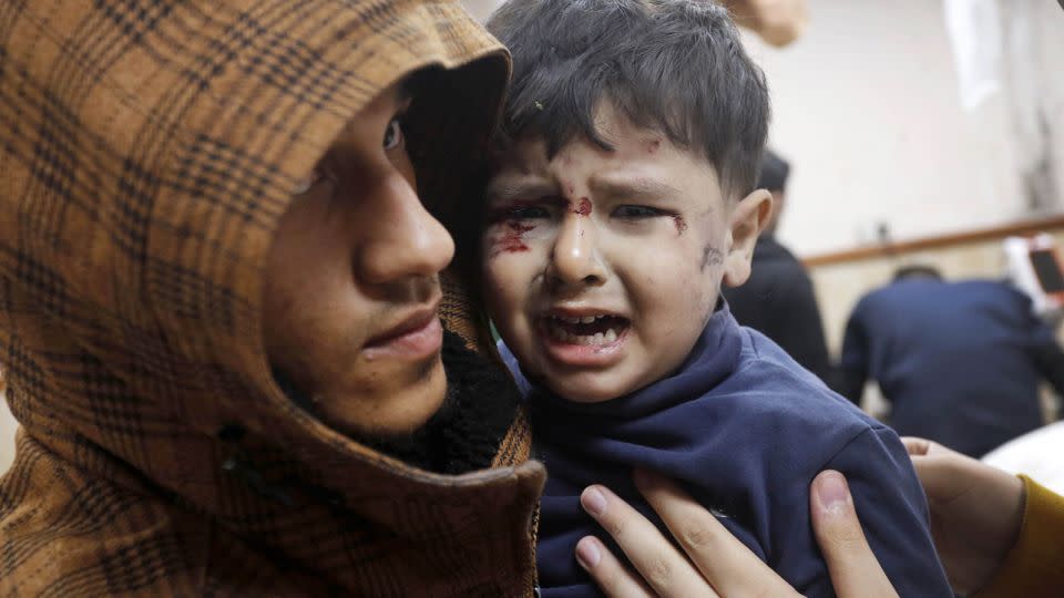 An injured Palestinian child taken to the Al-Aqsa Martyrs Hospital in Gaza for treatment on December 23, 2023. - Ashraf Amra/Anadolu/Getty Images/File