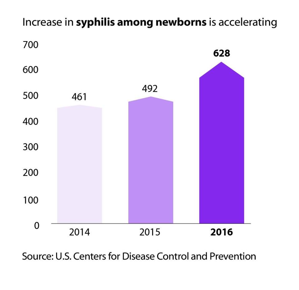 Congenital syphilis cases spiked by 28 percent from 2015 to 2016. (Photo: CDC)