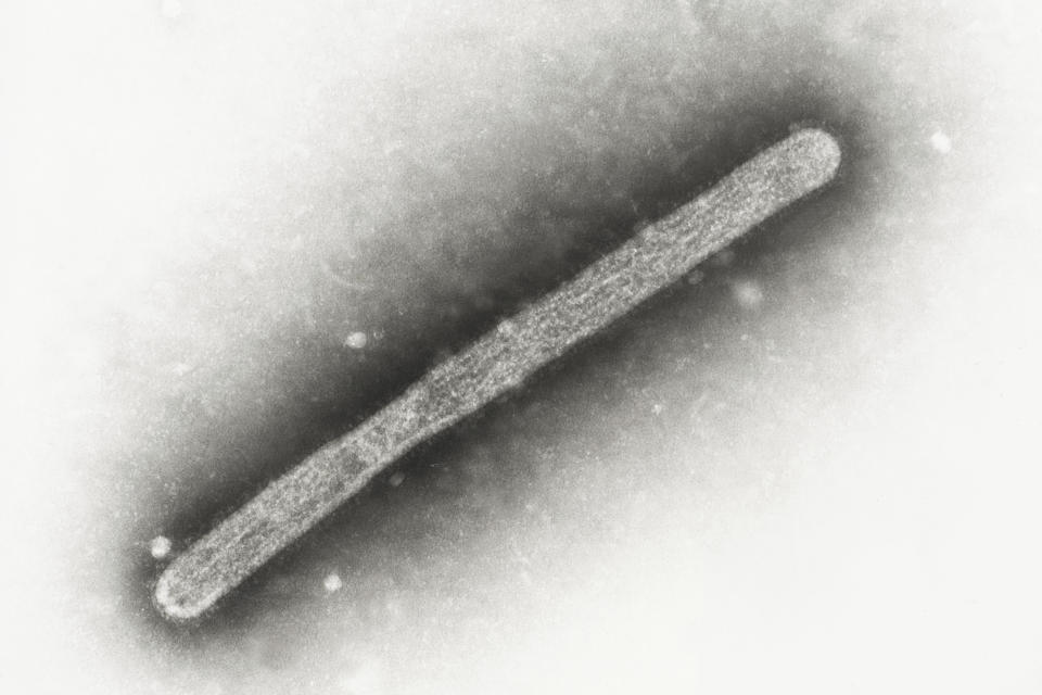 Esta imagen captada con un microscopio electrónico en 2005 muestra un virión de influenza aviar A H5N1. (Cynthia Goldsmith, Jackie Katz/CDC vía AP)