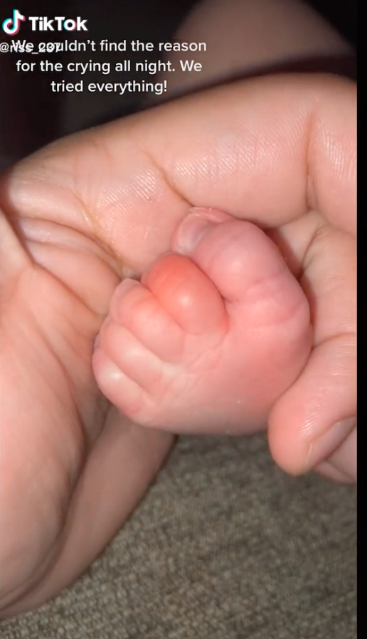 TikTok mum details frightening find on baby's toe: 'Another fear unlocked