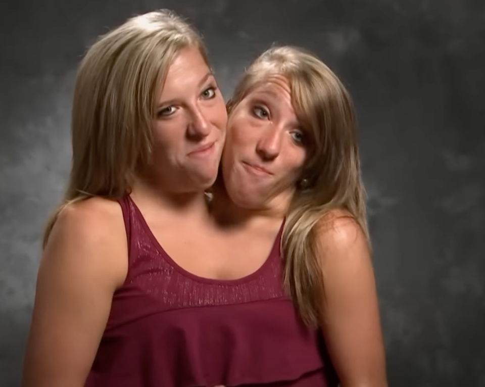 Conjoined twin Abby Hensel from Abby & Brittany privately married army veteran (Origin / YouTube)