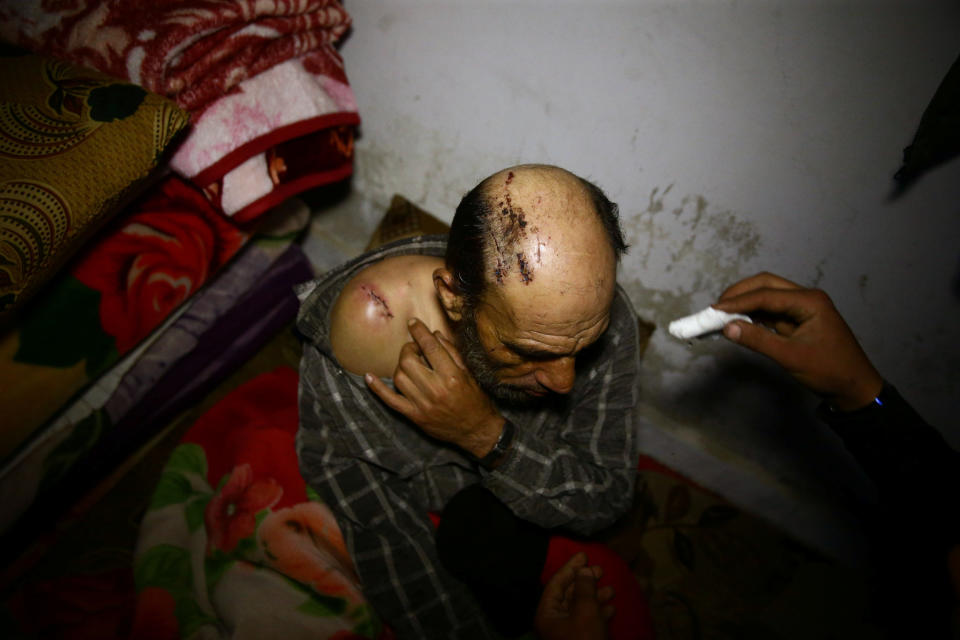 A wounded man in a shelter in Douma, Syria, on March 11, 2018. (Photo: Bassam Khabieh/Reuters)