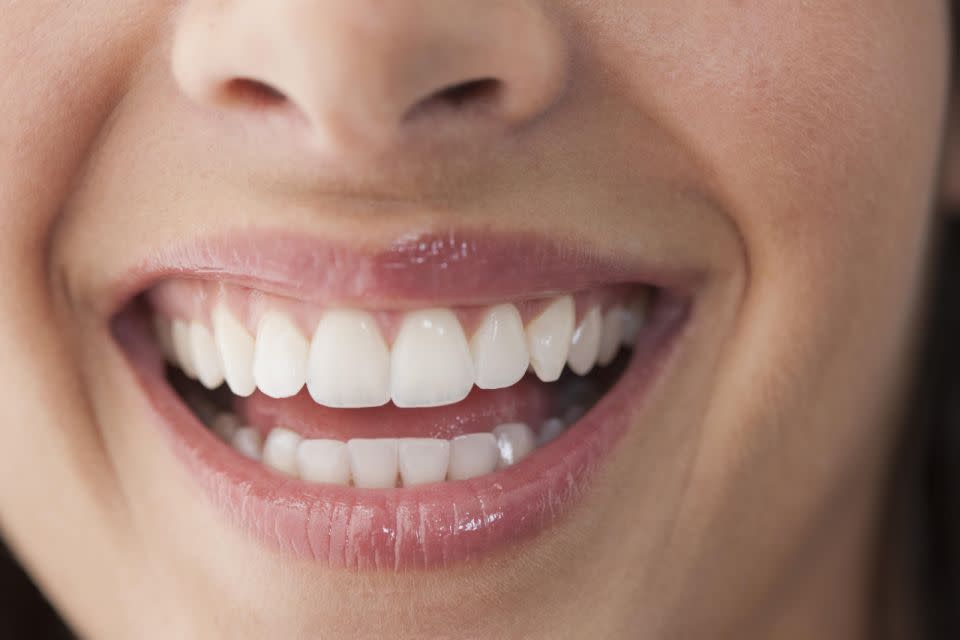 There are a host of teeth whitening options out there. Photo: Getty