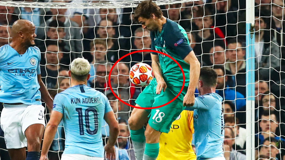 Fernando Llorente’s winning goal appeared to be handball. (Photo by Robbie Jay Barratt – AMA/Getty Images)