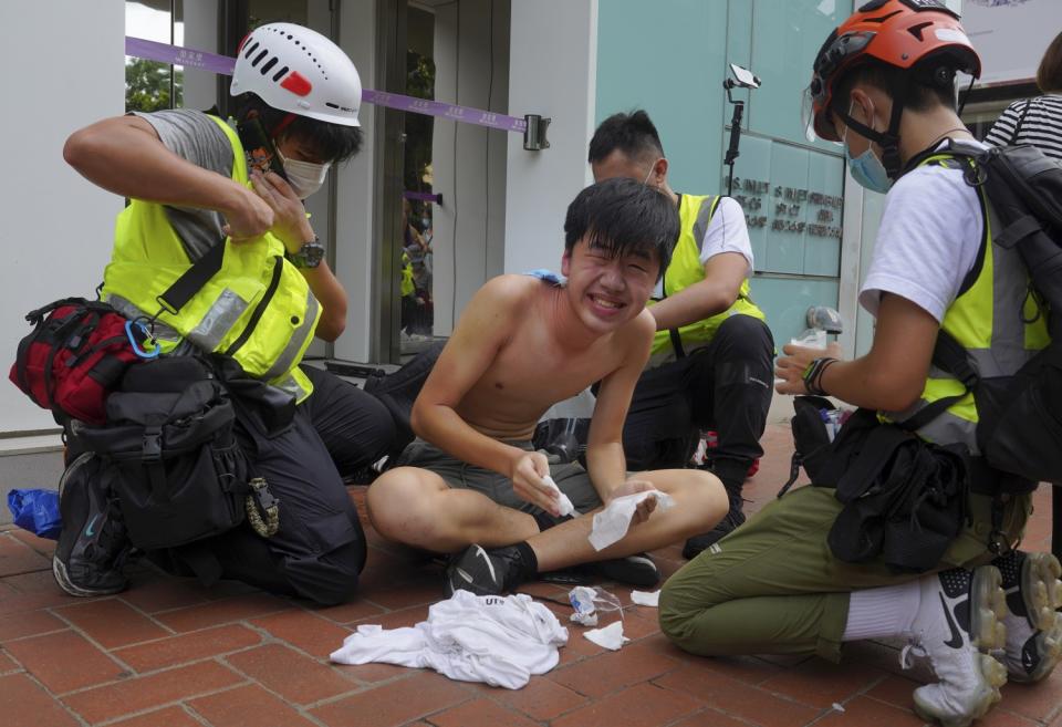 A journalist is treated after being hit by pepper spray during a security law protest in Hong Kong on Wednesday.