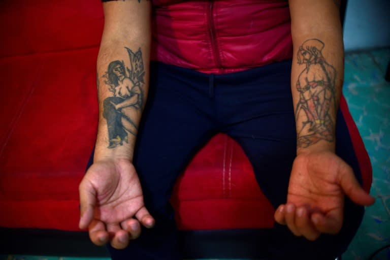 Mario Hidalgo, who worked for a decade as a pimp, says he wants to remove his tatoos of naked and bound women because they remind him of his past