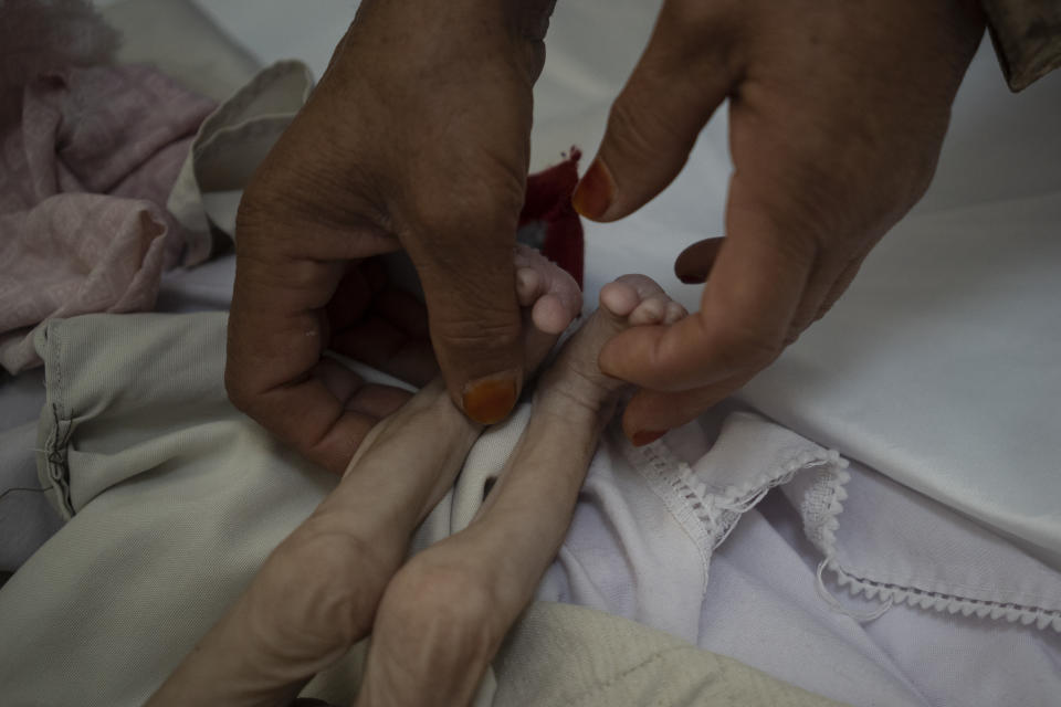 The stepmother of Mohammed, 4 years old, who is malnourished, holds his legs in the Indira Gandhi hospital in Kabul, Afghanistan on Monday, Nov. 8, 2021.The number of people living in Afghanistan in near-famine conditions has risen to 8.7 million according to the World Food Program. (AP Photo/Bram Janssen)