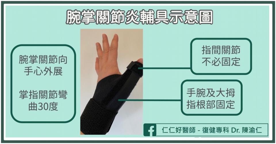 腕掌關節炎的治療方法