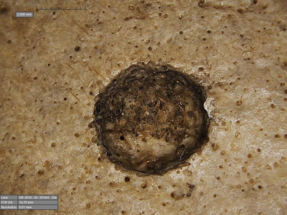 Cutmarks found on the skull of a male individual, thought to have been made with a sharp object