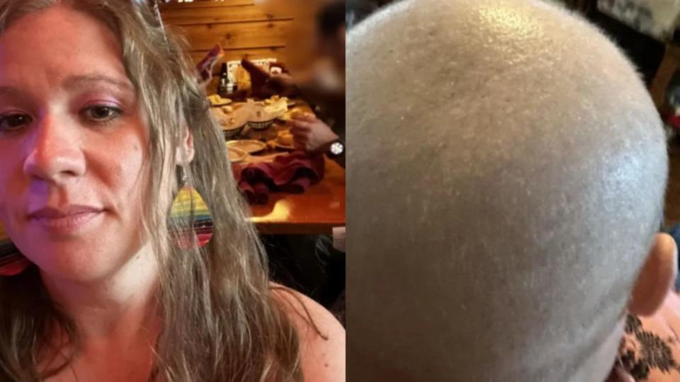 麗莎（Lisa Monk）白接受化療頭髮掉光。（圖／翻攝自《紐約郵報》）