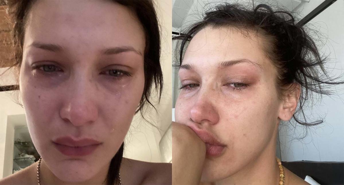 Bella Hadid speaks out about her recovery from health problems