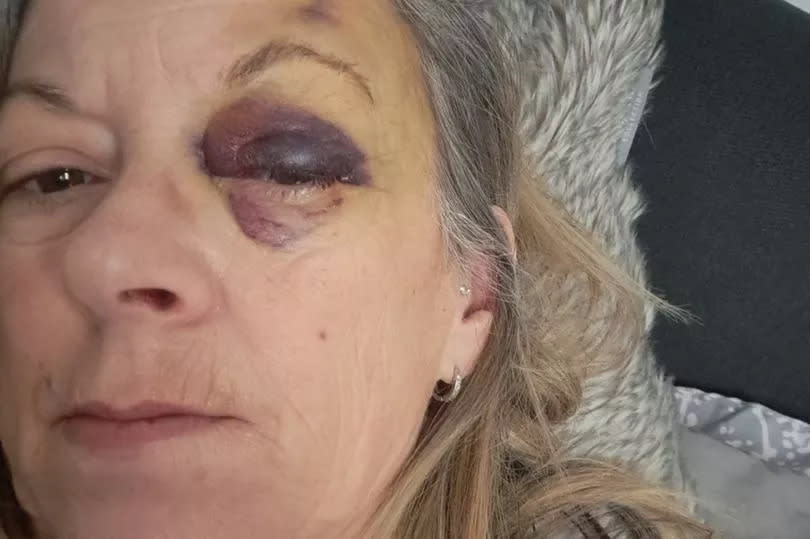 Sue Wood, 58, waited on the floor for over five hours for an ambulance