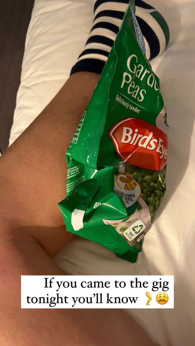 Alan sparked concern after posting a picture icing his leg after the show (Photo: Instagram)