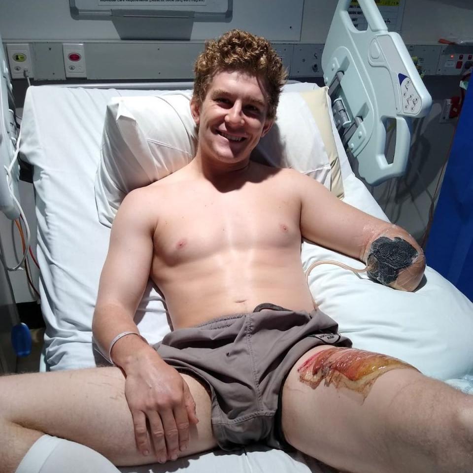 Henry Dunn is still recovering after losing an arm in an accident on a farm in Australia (Henry Dunn)