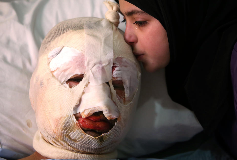 Fatima, 13, weeps as she kisses her injured father, Ahmad al-Messmar, 40, who was wounded when a deadly car bomb blew up Saturday evening near a gas station, in the predominately Shiite town of Hermel, about 10 miles (16 kilometers) from the Syrian border in northeast Lebanon, Sunday, Feb. 2, 2014. A shadowy Lebanese Sunni extremist group late Saturday claimed responsibility for a suicide car bombing in Hermel, a stronghold of Lebanon's militant Hezbollah group, that killed several people in the latest attack linked to the war in neighboring Syria. (AP Photo/Hussein Malla)