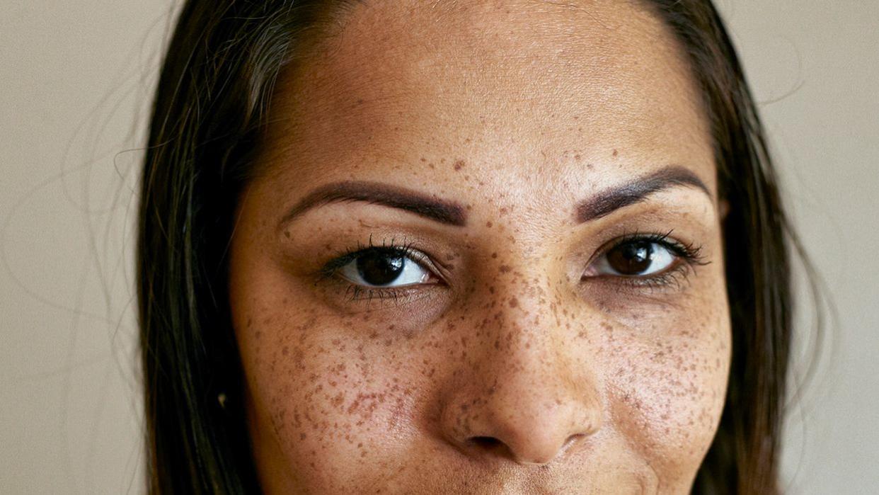 Woman with freckles