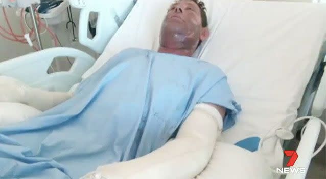 A Perth father was left with serious burns after a garage fire on Monday night. Source: 7 News