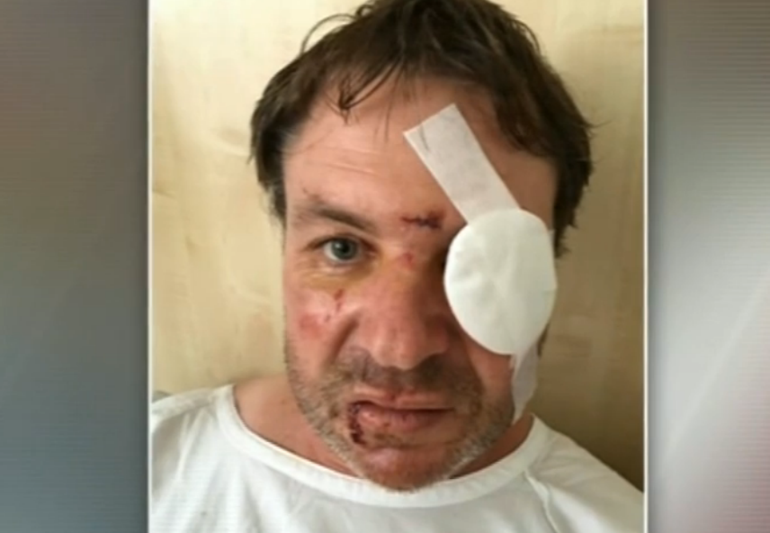 Photo: Grant O'Neill was brutally bashed in his own home.