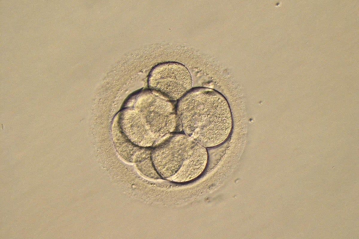 A photo of a three-day-old human embryo (PA Archive)