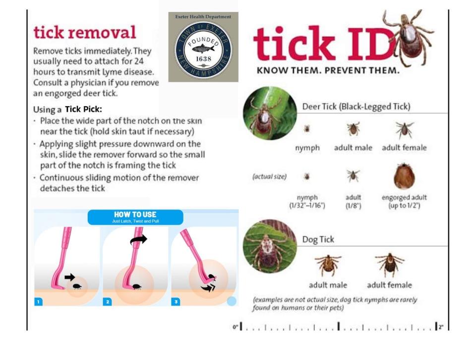 The Exeter Health Department has announced plans to launch a tick prevention program aimed at reducing the risk of infection this season.