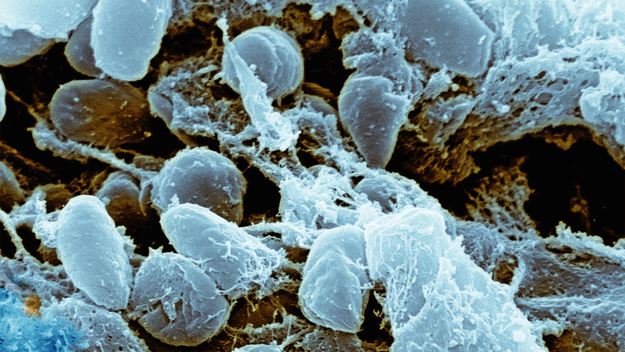  A microscopic image showing cells of the bacterium that causes plague depicted in light blue. 