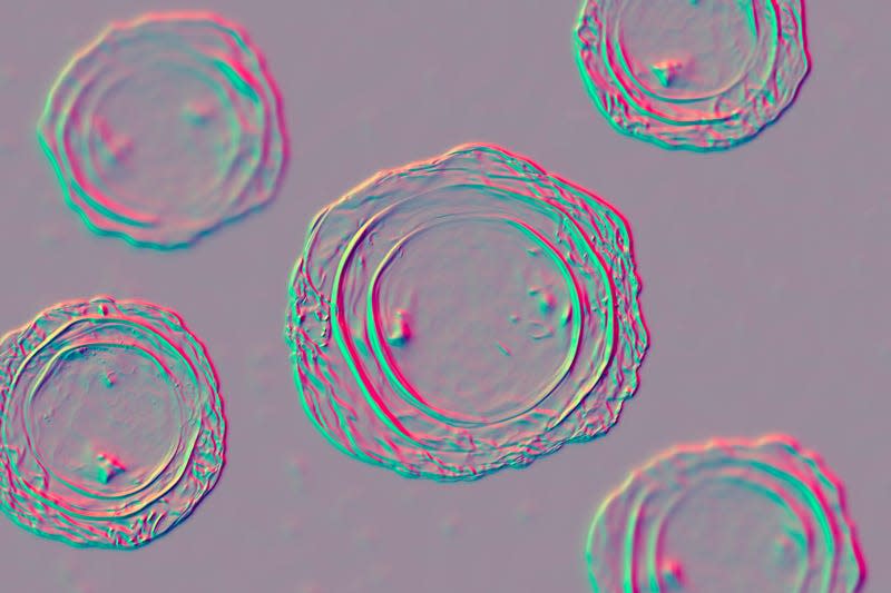 An illustration of fertilzed Ascaris lumbricoides eggs - Illustration: Science Photo Library (AP)