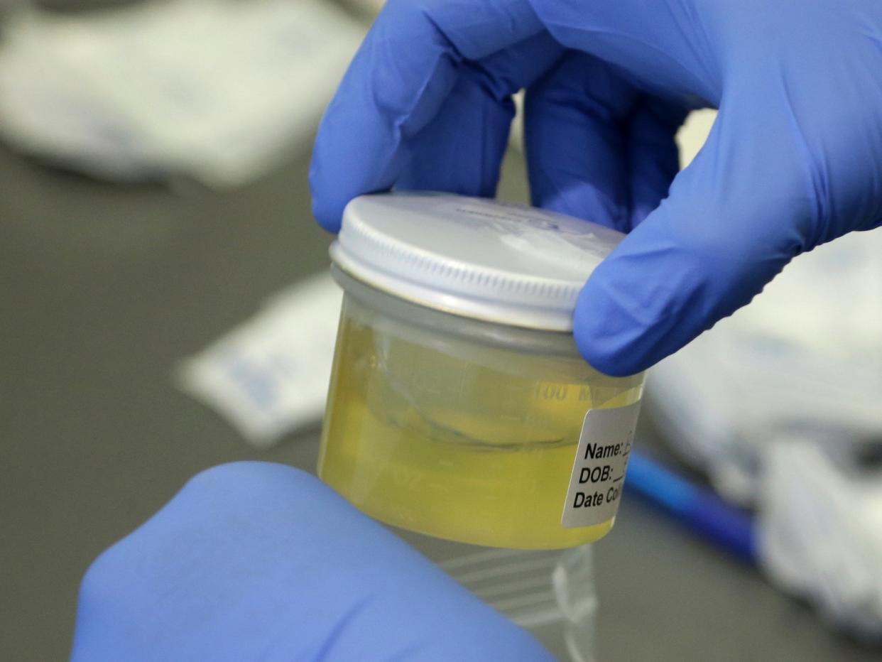 UTI antibiotic resistant bacteria urine sample pee