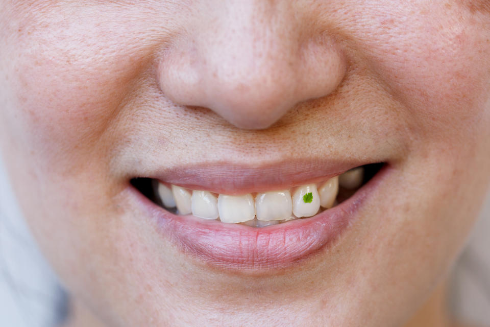 A close-up of a smiling face with a piece of green food stuck between their front teeth