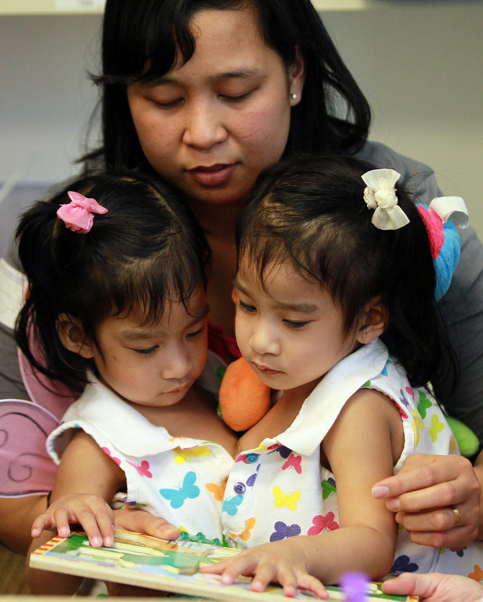 Surgeons Prepare To Separate Conjoined Twin Toddlers