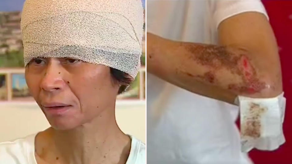 Mauricia Villanueva, 65, said she thought she was going to die as a young thug drove off with her head and limbs scraping along the road. Source: 7 News