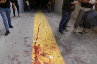 Supporters of a Shiite group allied with Hezbollah stand next to blood from an injured comrade during armed clashes that erupted during a protest in the southern Beirut suburb of Dahiyeh, Lebanon, Thursday, Oct. 14, 2021. It was not immediately clear what triggered the gunfire, but tensions were high along a former civil war front-line between Muslim Shiite and Christian areas. (AP Photo/Hassan Ammar)