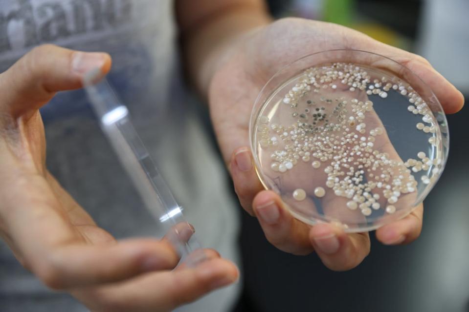 Lin Shiou-ruei holds up a container of microorganism pure culture for research on pest growth (Reuters)