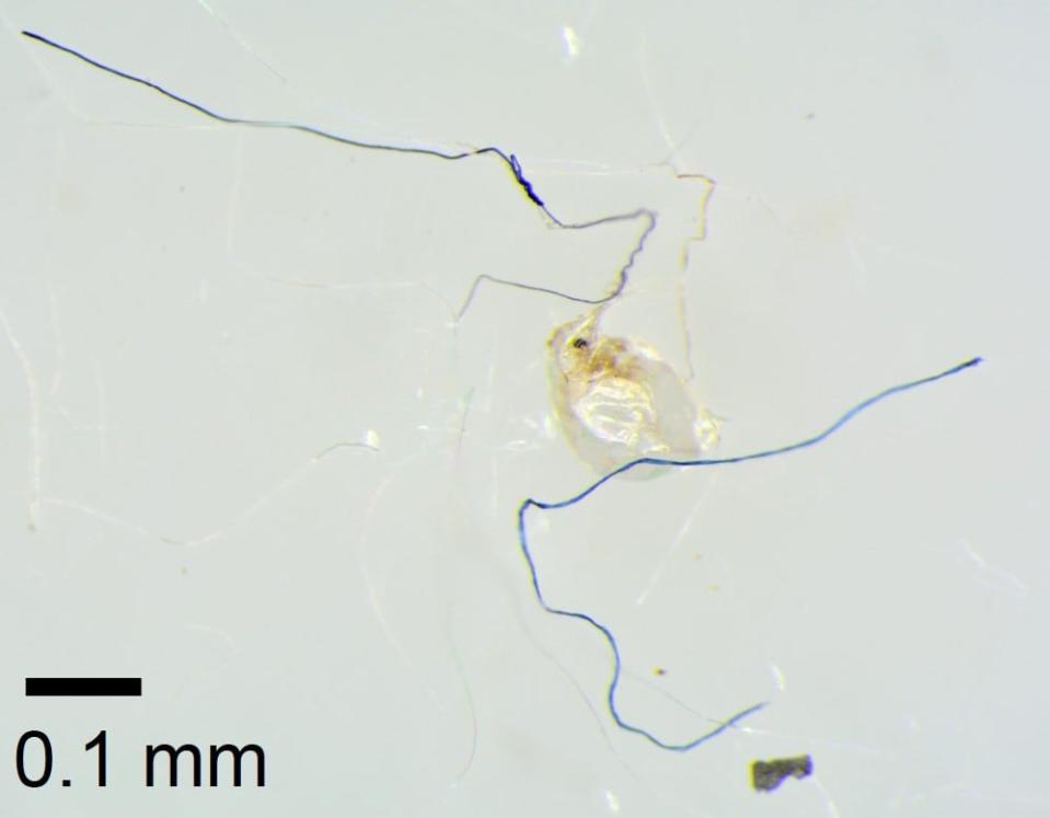 Microfibers alongside zooplankton from Lake Maggiore, Italy.