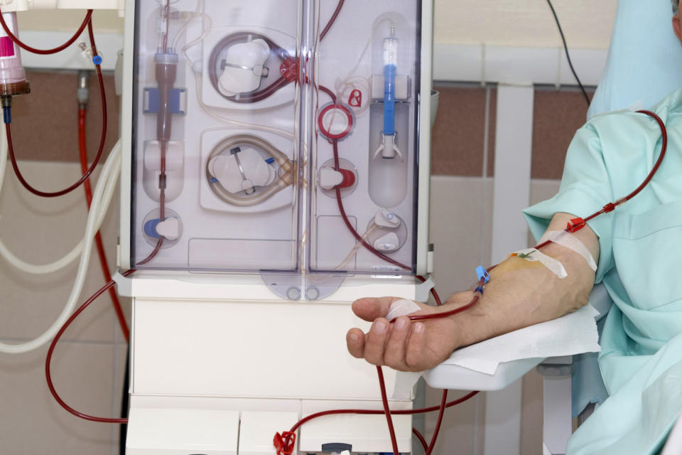 Dialysis, a common treatment for kidney disease, is far from pleasant, andcompanies and researchers are constantly working to improve the process