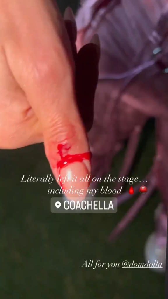 Furtado later took to Instagram to let fans know that she was alright and to show off her bloody thumb. Nelly Furtado/Instagram