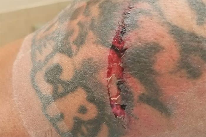 Brown was left with a nasty gash to his arm following the ordeal. Source: Instagram/Steve Brown