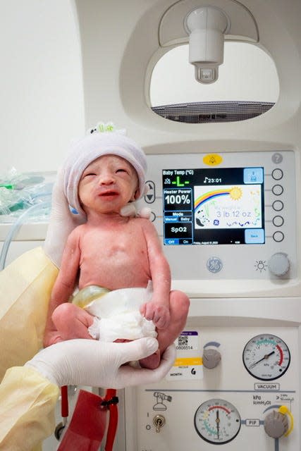 Paxton Abraham was born weighing just 3 pounds, 12 ounces, but his eyes were open, and he was breathing on his own.