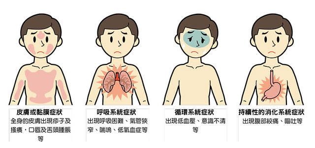 過敏性休克的症狀